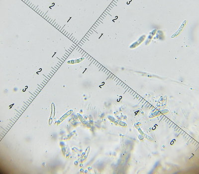 Echinosphaeria canescens 004 ascospores 14-5-2016.JPG