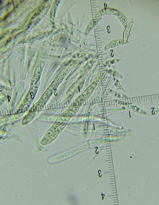 Phaeosphaeria eustoma 003 asci & spores 9-5-2016.JPG