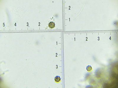 Scleroderma areolatum 002 spores 11-13 microns 2017-9-9.JPG