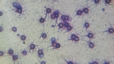 RBC cell wall shedding p2