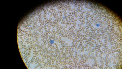 High contrast stain 1