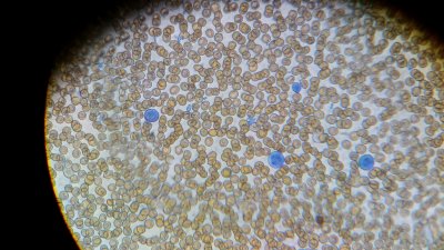 High contrast stain 4