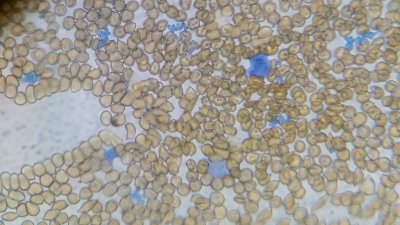 High contrast stain 6
