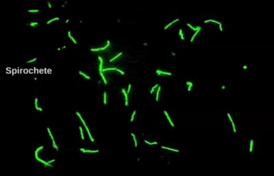 Immuno stain 1