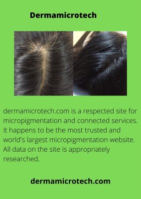 Scalp micropigmentation women