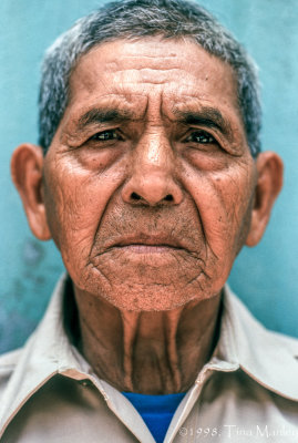 Carlos Dominguez, Age 55, Cataracts