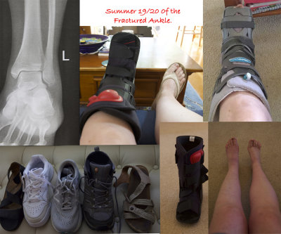 Ankle