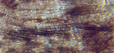 Geoglossum cookeanum, sporen met 7 septen, 400 X