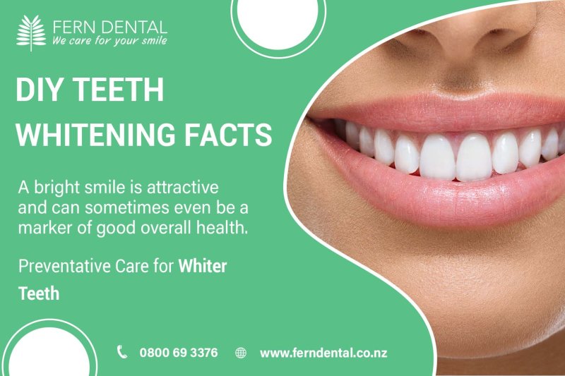 Best Teeth Whitening | Teeth Whitening
