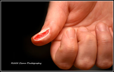 My poor wife sliced off a piece of her thumb, whilst using her new potato peeler. 