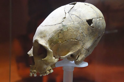Antakya Archaeological Museum Pointed head skull sept 2019 5754.jpg