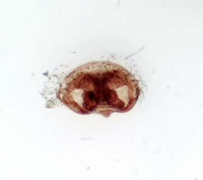 Stensa Halland 5.4-19 epigyn adult female