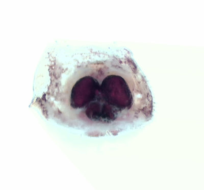 Fjrs brcka Halland 14.7-19 vulva adult female