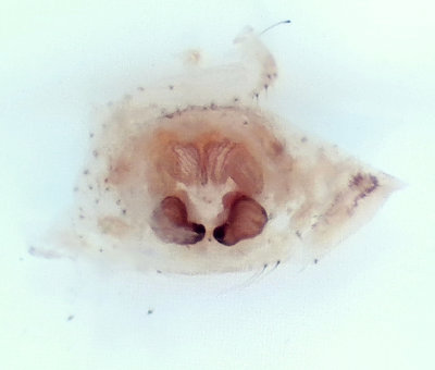 Xysticus kochi ( Gruskrabbspindel ) vulva