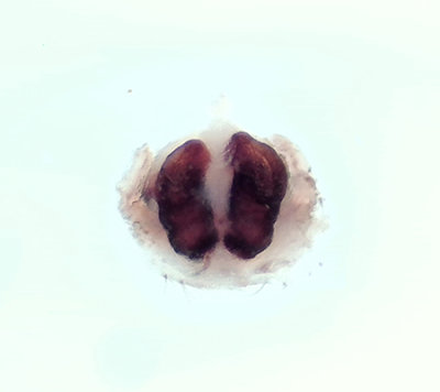Xysticus lanio ( Lvkrabbspindel ) vulva