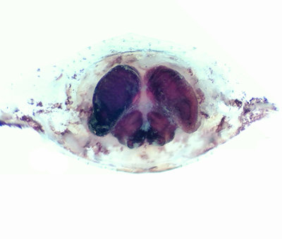 Fjrs brcka Halland 14.7-19 vulva adult female