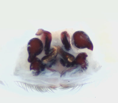 Sbytorp Vstmanland 24.6-22 vulva adult female