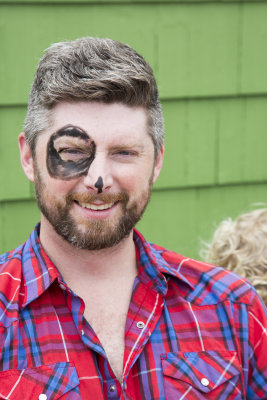 Black eye Kyle