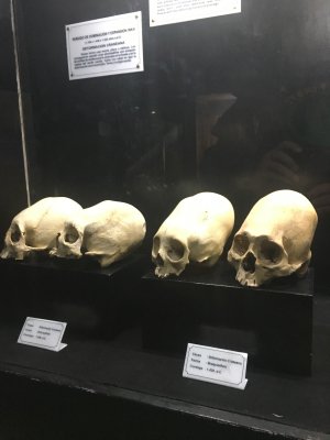 Elongated Skulls - Qorikancha Museum