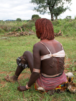 A whipped Hamar woman with bleeding back