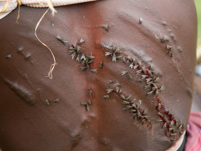 The bleeding back of a Hamar woman