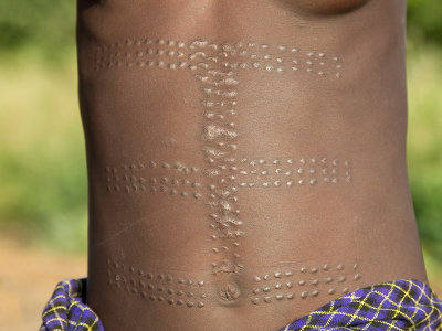 Skin scarifications