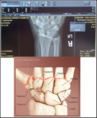 WristProblem1.jpg