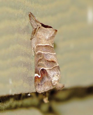 Sigmoid Prominent