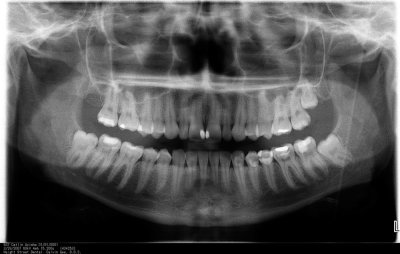 ayisha_teeth-20070329-1000x636-RGB.jpg
