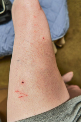 OUCH! I wish these kitties would be more careful!      IMG_6347.jpg