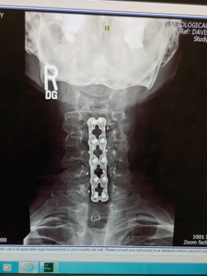 neck01.jpg