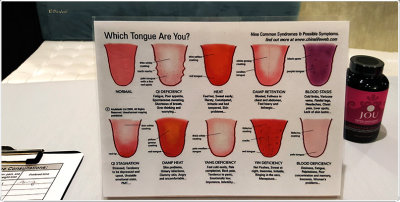 Which Tongue Are You?