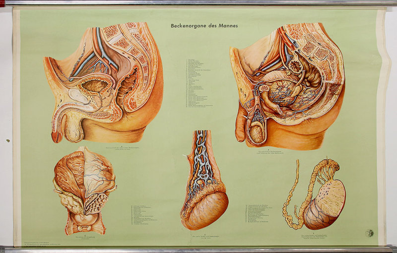 AVM V 17 05 010 000.jpg