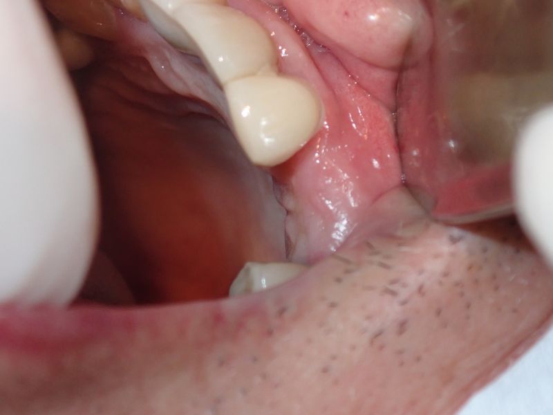 P4150002.JPG