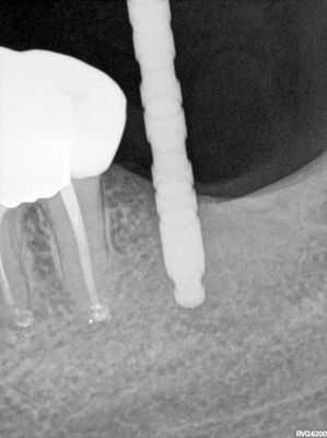 R2.jpg