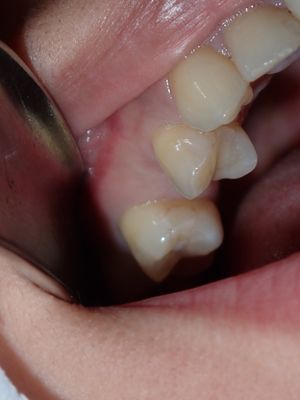 P1130004.JPG