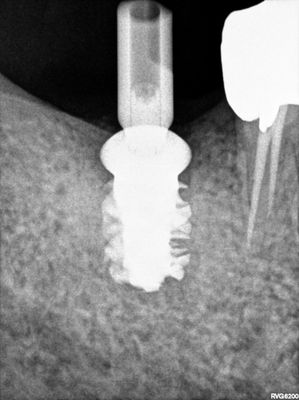 ALai - 24
