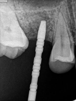 R1.jpg