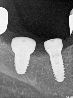 R11.jpg