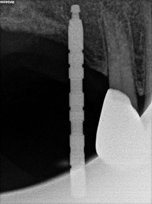 Tseng Chi Fan 16.jpg