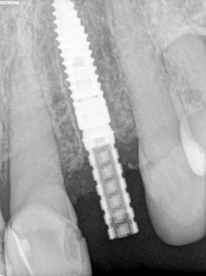 NSankhyan - 22 immediate