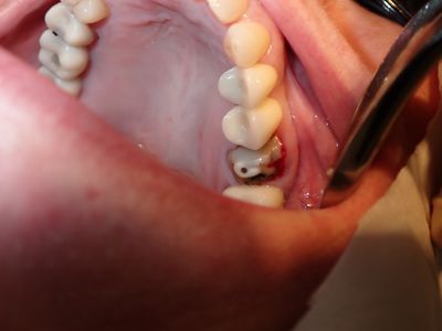 NSankhyan - immediate 26