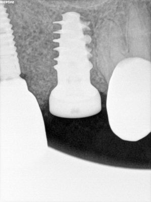 NSankhyan - immediate 26
