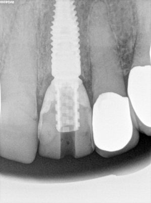 NSankhyan - immediate 21