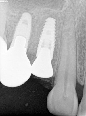 NSankhyan - immediate 14