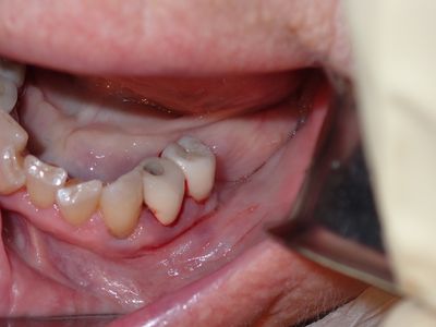 NSankhyan -  34 immediate placement