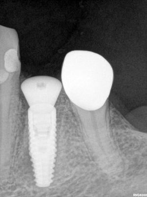 NSankhyan - 34 immediate placement