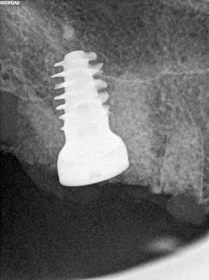 ARumiantsava - immediate 16