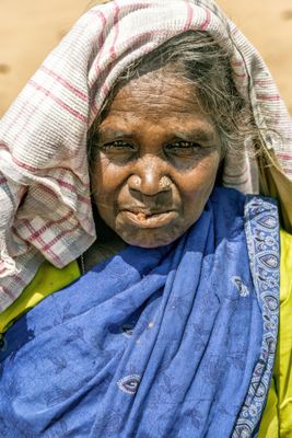 Tea Picker with Problem Tooth!