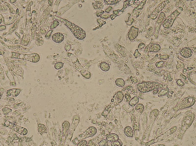 Spitse wasplaat sporen en cystiden, Hygrocybe subglobispora